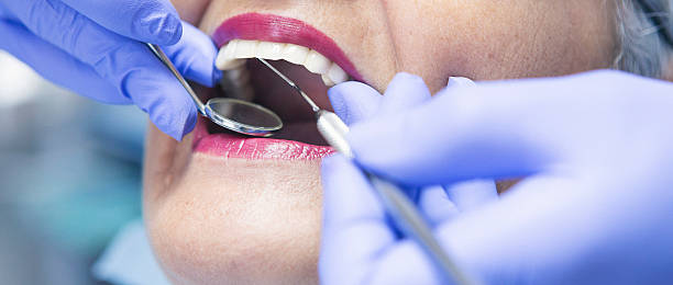 Best Emergency Treatment for Toothache in Fanning Springs, FL